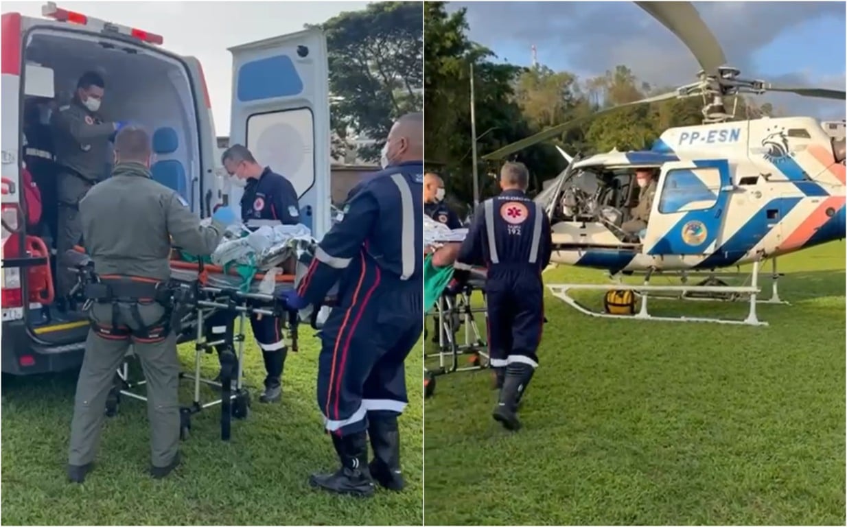 João Neiva | Homem tem metade do corpo queimado ao acender churrasqueira com álcool