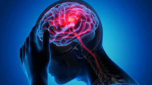 AVC mata uma pessoa a cada seis horas no ES