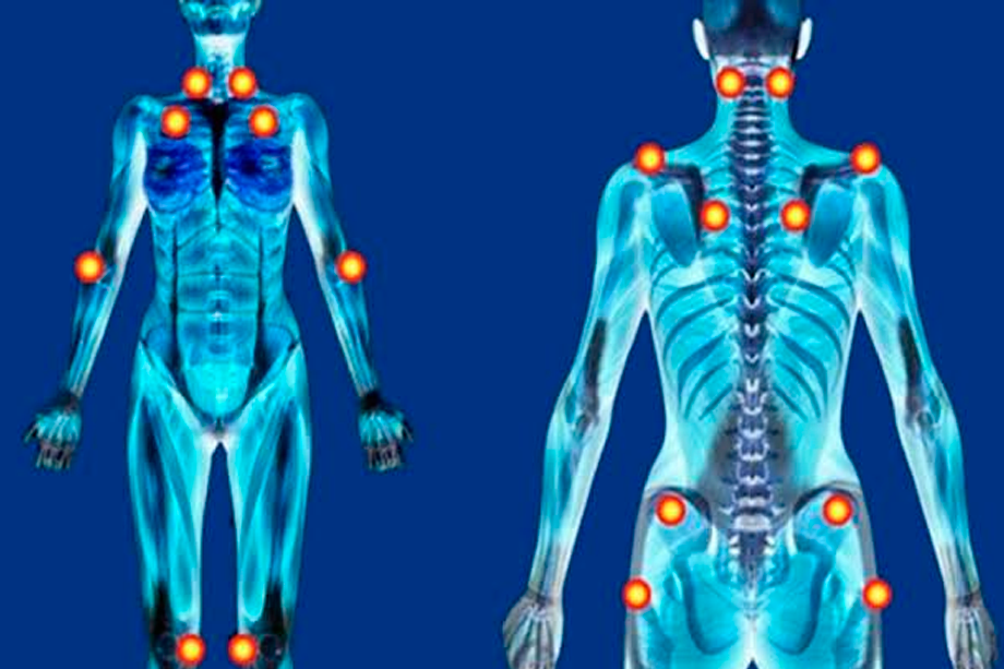 Passos de Fibra: João Neiva caminha pela conscientização da fibromialgia